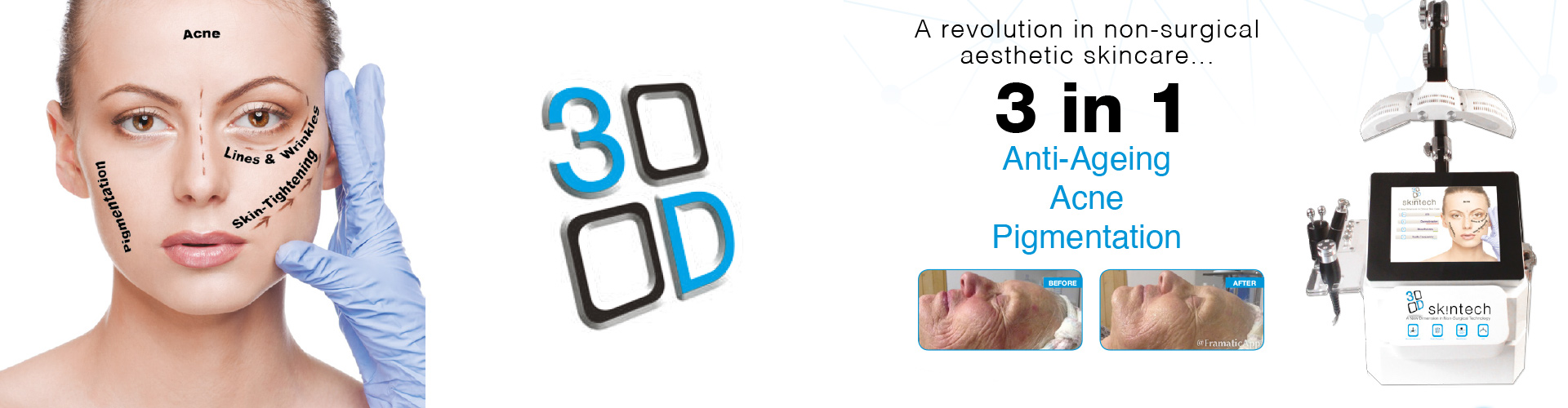 3D SkinTech | Flawless Body